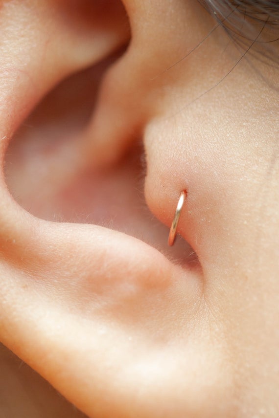 أسهل علاج للتهاب خرم الاذن أو مكان ثقب حلق الاذن وشفاء تورم الغضروف طبيعيا Youtube